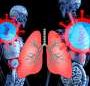 Younger adults with lung cancer more likely to have targetable genetic changes, study finds