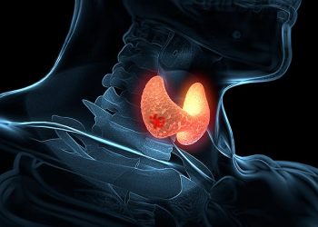 TERT Variants, Not Age, Predict Thyroid Cancer Outcomes
