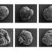 Cell ‘invisibility cloaks’ could offer side-effect-free diabetes treatment