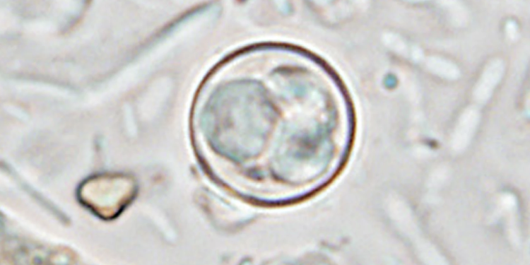 Some states say Cyclospora outbreak is slowing