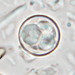 Some states say Cyclospora outbreak is slowing