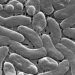 Amid Flesh-Eating Bacteria Deaths, Health Officials Urge Caution for Beachgoers