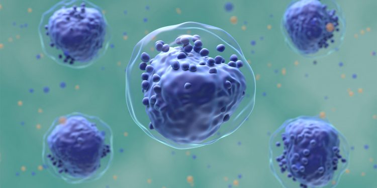 Liposomal Chemo Combination No Better Than Standard Induction in Pediatric AML
