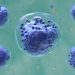 Liposomal Chemo Combination No Better Than Standard Induction in Pediatric AML
