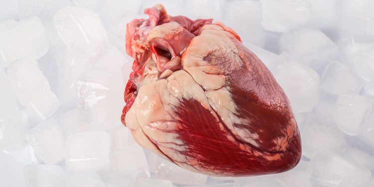 Donor Hearts May Work Better if Stored Slightly Warmer