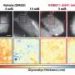 High glucose thickens cancer cells’ sugar shield, helping them evade immune attack