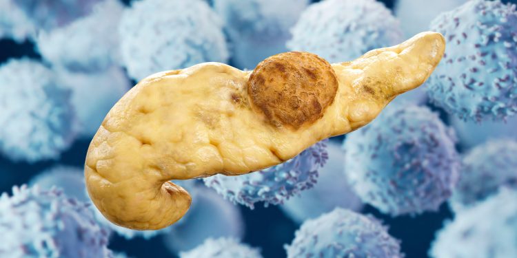 Pancreatic Cancer Vaccine Shows Interception Promise in High-Risk Patients