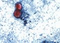 Michigan Reports First Two U.S. Deaths Related to Diarrhea-Causing Parasite