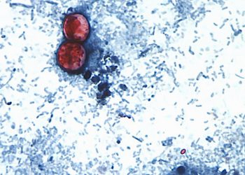 Michigan Reports First Two U.S. Deaths Related to Diarrhea-Causing Parasite