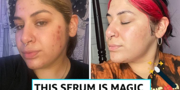 26 Skincare Products That Get A Lot Of Hype But Aren’t *Just* Hype