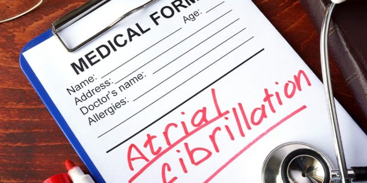 Assessing Function in AF: Physical Performance Tool Reliable