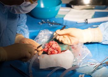 COVID Study Supports Antiviral Use in Kidney Transplant Recipients