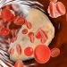 Cardiologists Say Adding This Quick Test Gives a  Clearer Picture on Cholesterol Levels