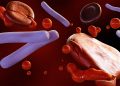 Two Symptoms Linked to Antibiotic Delays in Presumed Sepsis