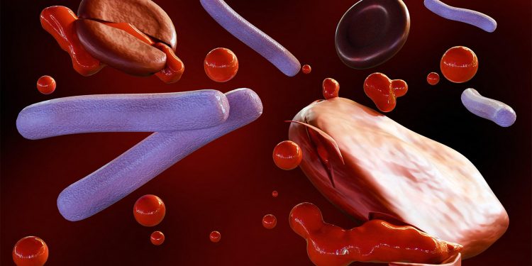 Two Symptoms Linked to Antibiotic Delays in Presumed Sepsis