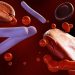 Two Symptoms Linked to Antibiotic Delays in Presumed Sepsis