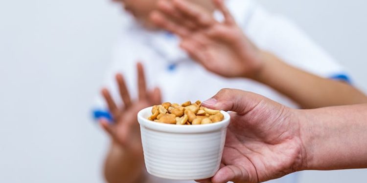 OFC Delabels Peanut Allergy in More Than a Third of Infants