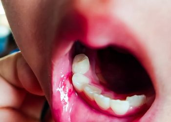 Genital Aphthosis Linked to Systemic Diagnoses in Children