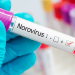 Source of Belgian norovirus outbreak remains unknown
