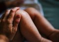 Infant Eczema Location Tied to Risk for Food Allergy