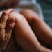 Infant Eczema Location Tied to Risk for Food Allergy