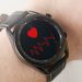 A Samsung Galaxy Watch Detected AFib Before Doctors Discovered Serious Heart Problems