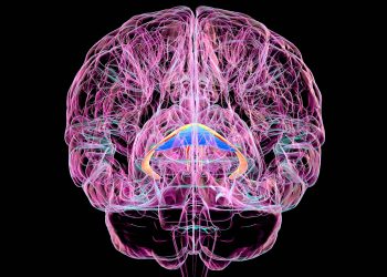 Brain Disorder Due to Vitamin Deficiency Often Goes Unrecognized