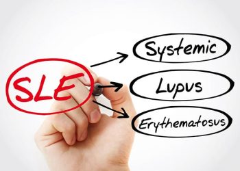 SLE Linked to Increased Risk for Stroke