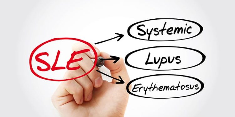 SLE Linked to Increased Risk for Stroke