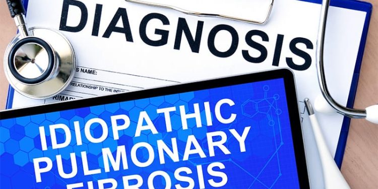 Experts Debate Combination Therapy for Pulmonary Fibrosis