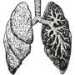 Combination therapy does not meet primary endpoints in first-line PD-L1-high metastatic non-small cell lung cancer