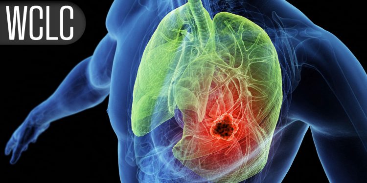Local Consolidative Therapy After Dual Immunotherapy Fizzles in Metastatic NSCLC