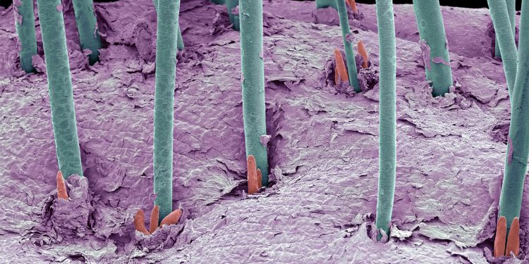 Parasite Infestation Common in Eyelash Extensions, Study Suggests