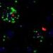 Brain signaling mechanism may explain clozapine weight gain
