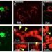 A closer look at hard-to-see cells could answer new questions about nerve damage and recovery