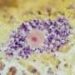 Macrophage ‘molecular scissors’ may drive obesity-linked inflammation and metabolic damage
