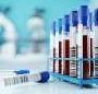 FDA authorizes first standalone robotic device to draw blood