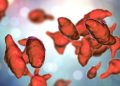 Macrolide Resistance Common in M genitalium Infections
