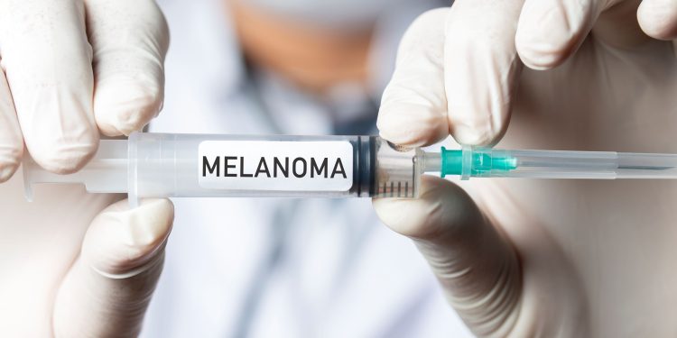 New mRNA Vaccine Reduces Risk of Melanoma Recurrence by Over 40 Percent
