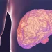 MASH: Efruxifermin Linked to Sustained Fibrosis Response